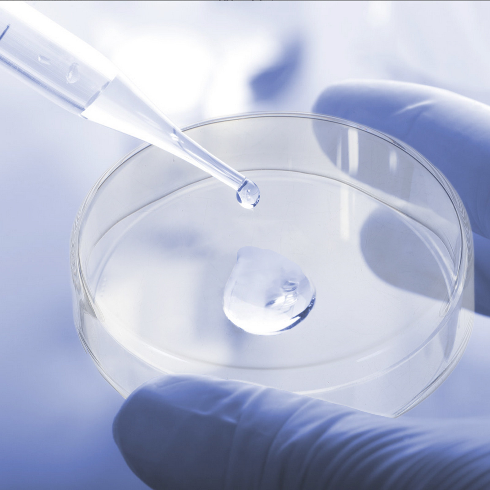 1セットの厚いガラス製ペトリ皿、オートクレーブ滅菌可能な皿、 - Agar Tissue Culture のレビューと価格