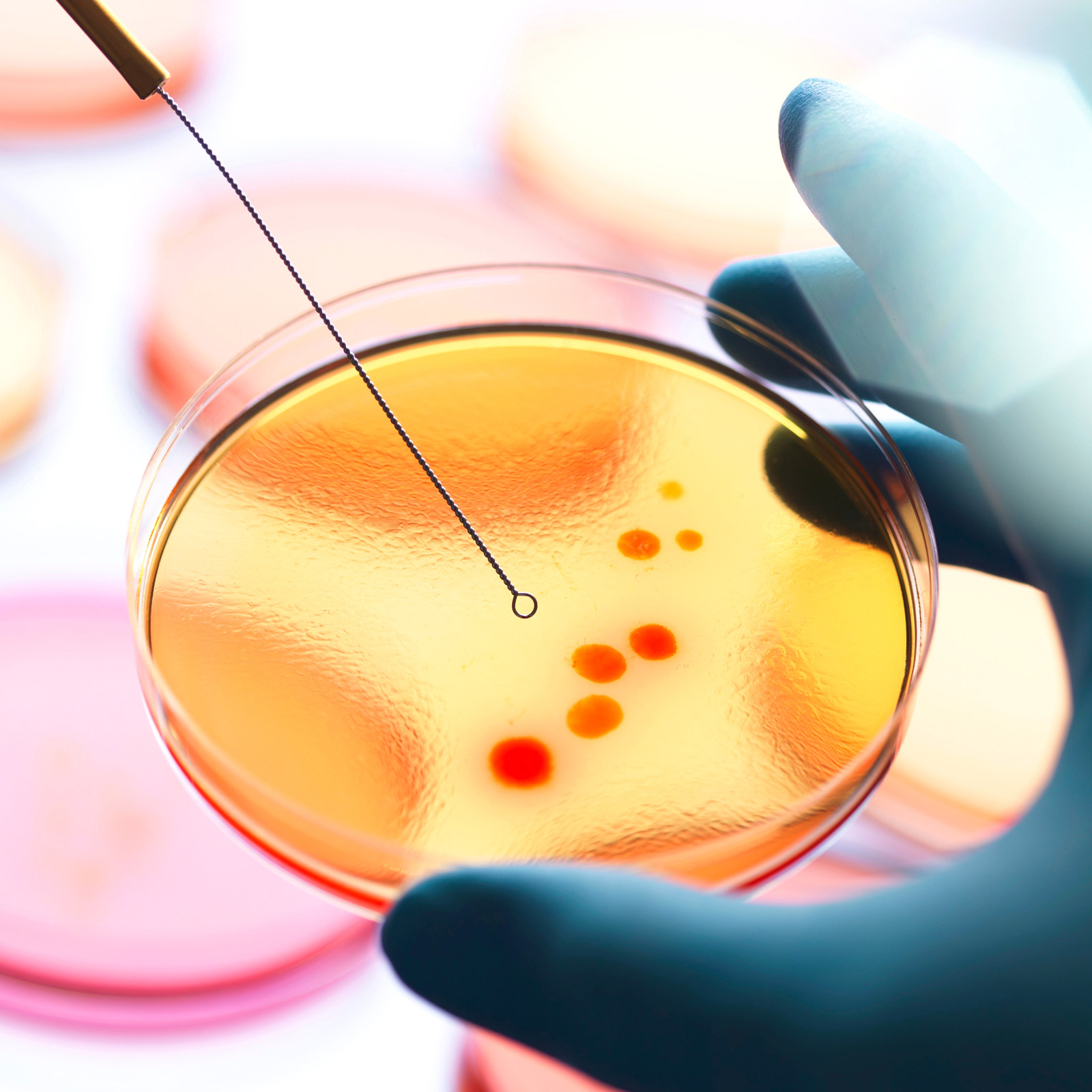 20個入りプレポアード寒天培地プレート、栄養寒天ペトリ皿、科 - Agar Tissue Culture のレビューと価格